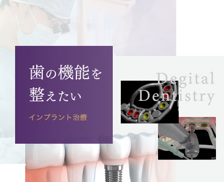 歯の機能を整えたい：インプラント治療