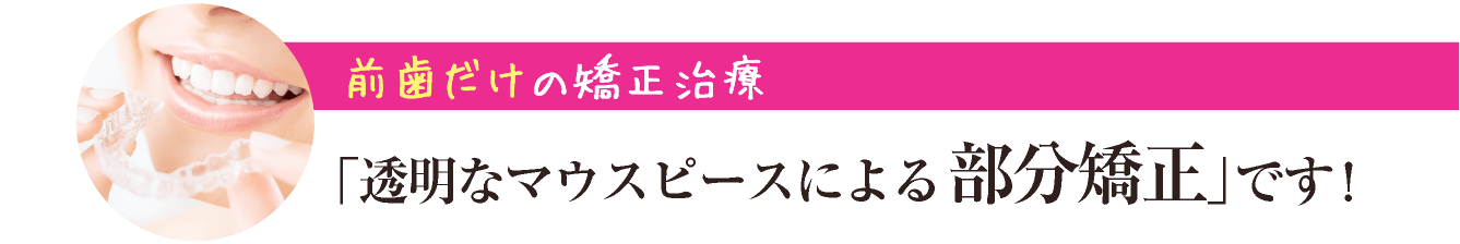 前歯だけの矯正治療「インビザラインシステム」です！