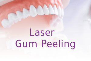 Laser Gum Peeling