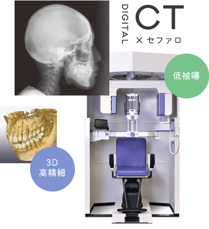 3D高精細 CT×セファロ