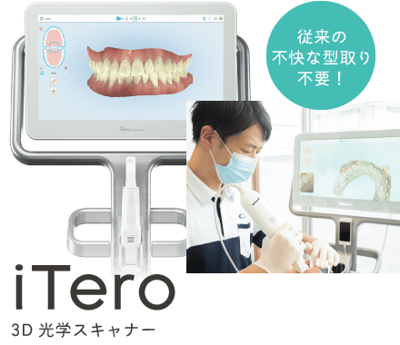 従来の不快な型取り不要！ iTero：3D光学スキャナー